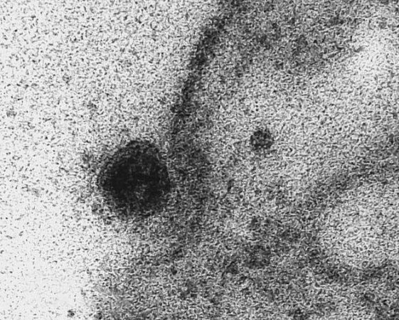 لحظه‌ی آلوده شدن سلول‌های سالم به “کروناویروس” ثبت شد+تصاویر